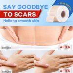 Wifamy Silicone Scar Sheets for Women: Medical Grade Scar Removal C-Section Recovery & Post-Surgery Care (1.6"X 120" Roll-3M) - Image 4