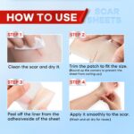 Wifamy Silicone Scar Sheets for Women: Medical Grade Scar Removal C-Section Recovery & Post-Surgery Care (1.6"X 120" Roll-3M) - Image 5
