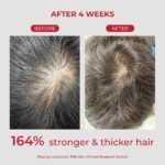 ANNURCATIN Shampoo for strengthening and volumizing thinning hair - Korean Biotin Apple Fresh Shampoo, Build Lift, Paraben-Free, suggested to All Hair Types (10.14 fl.oz, apple & freesia) - Image 5
