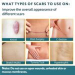 Silicone Scar Sheets, Silicone Scar Tape for Surgical Scars - 60" x 1.6" Roll - 1.5M, Medical Grade Reusable Effective Scar Removal for Keloid, C-Section, Tummy Tuck, and Acne - Image 3