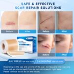 Silicone Scar Sheets, Silicone Scar Tape(1.8” x 157” Roll 4M), Silicone Scar Sheets for Surgical Scars, Keloid Bump Removal, Stretch Marks Removal, C-Section, Burn et - Image 5
