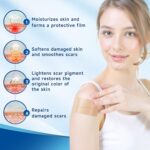 Silicone Scar Sheets, Silicone Scar Tape(1.8” x 157” Roll 4M), Silicone Scar Sheets for Surgical Scars, Keloid Bump Removal, Stretch Marks Removal, C-Section, Burn et - Image 6
