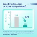 Disposable Face Towels,Ultra Thick Face Towelettes XL, Lint-Free Facial Wipes for Makeup Removal & Gentle Skin Care,50 Count, 10"×12", Pearl-textured - Image 4