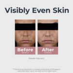 Eucerin Radiant Tone Dual Serum Dark Spot Corrector, Dark Spot Serum with Thiamidol and Hyaluronic Acid, Helps Visibly Reduce the Look of Persistent Dark Spots, 1 Fl Oz Bottle - Image 4