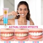 2Pcs Niacinamide Whitening Toothpaste Radiant Whitening Toothpaste, Niacinamide Intensive White Toothpastes, Nicotinamide White Toothpastes, Deep Cleaning Care - Image 6