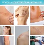 Advanced High-Potency Silicone Scar Gel with Vitamin E for Old, New Scars, Surgery, Keloids, Burns, and Facial Blemish Scars, NewGel Plus by MyNewGel (15 Grams) - 0.50 oz - Image 9