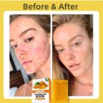 Kojic Acid & Turmeric Soap Bar for Dark Spot removal - Skin Lightening Soap with Vitamin C, Retinol, Shea Butter & Lemon Oil - for Face, Body, Underarms - SLS Free, for Oily & Dry Skin - Image 5