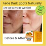 Kojic Acid & Turmeric Soap Bar for Dark Spot removal - Skin Lightening Soap with Vitamin C, Retinol, Shea Butter & Lemon Oil - for Face, Body, Underarms - SLS Free, for Oily & Dry Skin - Image 7