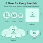 TKTK Pimple Patches for Face, 6 Sizes Hydrocolloid Acne Patch Variety, Large Acne Stickers for Cheeks, Forehead, Chin, Nose, Back Blemishes Zit Breakouts (4 Shapes 356 Count) - Image 4