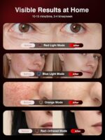 Red Light Therapy for Face，4D Red Light Therapy Mask with 4 Color Light Modes (Red+Infrared/Red/Blue/Orange), 850NM Infrared LED Face Mask Light Therapy with 4000mAh Rechargeable Remote, Timer - Image 7