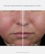 NEOSTRATA CLARIFY Mandelic Clarifying Hydra Gel, Matte Face Moisturizer for Oily and Acne Prone Skin, Exfoliates and Refines Pores with Salicylic Acid, Oil Free Hydration, Non-Comedogenic, 1.7 oz - Image 5