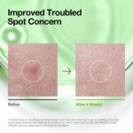 Anua Azelaic Acid 3 CICA Skin Claryfing Toner, Soothing & Clear Care, with Salicylic Acid & Azelaic Acid, Sebum & Spot Care, Suitable for Sensitive Skin, Korean Skin Care (250ml / 8.45 fl.oz.) - Image 6