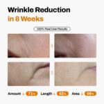 JEU'DEMEURE DermiShuttle Lifting Kit - Anti Aging Serum, Face Serum for Firming, Anti Wrinkle, Skin Elasticity, Hydrating with Collagen, Peptides, Korean Skincare (8 Weeks) - Image 4