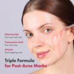 TOSOWOONG Niacinamide 10% + Tranexamic Acid 4% Serum, Arbutin 2%, Hyaluronic Acid, TXA Facial Serum, Glass Skin, Clarifying, Radiant Complexion with Natural Color, Korean Skin care, 33ml, 1.11 fl.oz. - Image 3