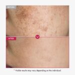 TOSOWOONG Niacinamide 10% + Tranexamic Acid 4% Serum, Arbutin 2%, Hyaluronic Acid, TXA Facial Serum, Glass Skin, Clarifying, Radiant Complexion with Natural Color, Korean Skin care, 33ml, 1.11 fl.oz. - Image 4