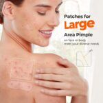 TKTK Hydrocolloid Bandages, 45 x 45 mm Large Pimple Patches for Face, XL Acne Patches for Body, Back, Forehead, Cheek Zit Breakouts, Big Hydrocolloid Patch (Square, Strip, Dot 5 Sizes 120 Count) - Image 4