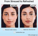 grace & stella Hypochlorous Acid Spray for Face - Body Acne Spray - Gentle Face Mist to Calm Redness & Flare-Ups Back Acne - Soothing Facial Mist for Sensitive Skin - Travel Size (60 ml/2 fl oz) - Image 5