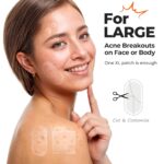 TKTK Large Pimple Patches for Face, 60 x 30 mm XL Acne Patches, Big Hydrocolloid Bandages for Body, Back, Forehead, Chin, Neck Blemish Zit Breakouts (Oval, Square, Dot 5 Sizes 124 Count) - Image 4