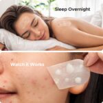 TKTK Large Pimple Patches for Face, 60 x 30 mm XL Acne Patches, Big Hydrocolloid Bandages for Body, Back, Forehead, Chin, Neck Blemish Zit Breakouts (Oval, Square, Dot 5 Sizes 124 Count) - Image 8